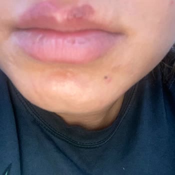 Aris Güzellik Merkezleri Güzellik Merkezinde Mobbing Ve Yanık Şikayeti