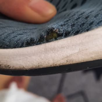 Adidas Ayakkabılarında Erken Açılma Ve Garanti Sorunu