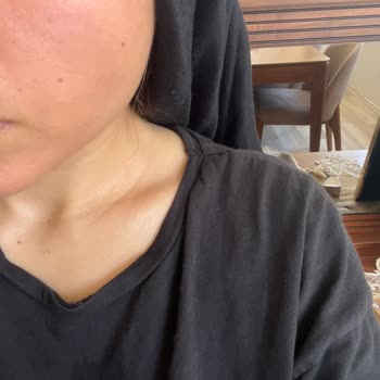 SHE Vec Kırmızı Serum