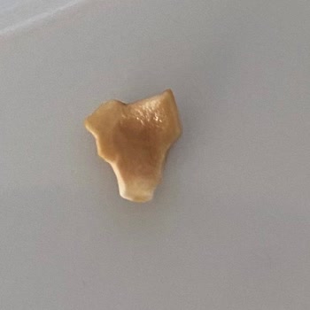 Eti Gıda Eti Çikolatadan Kabuk Çıktı
