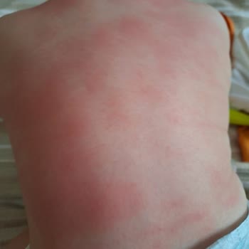 Iva Natura İva Natura Bebek Ürünleri Hk Şikayet