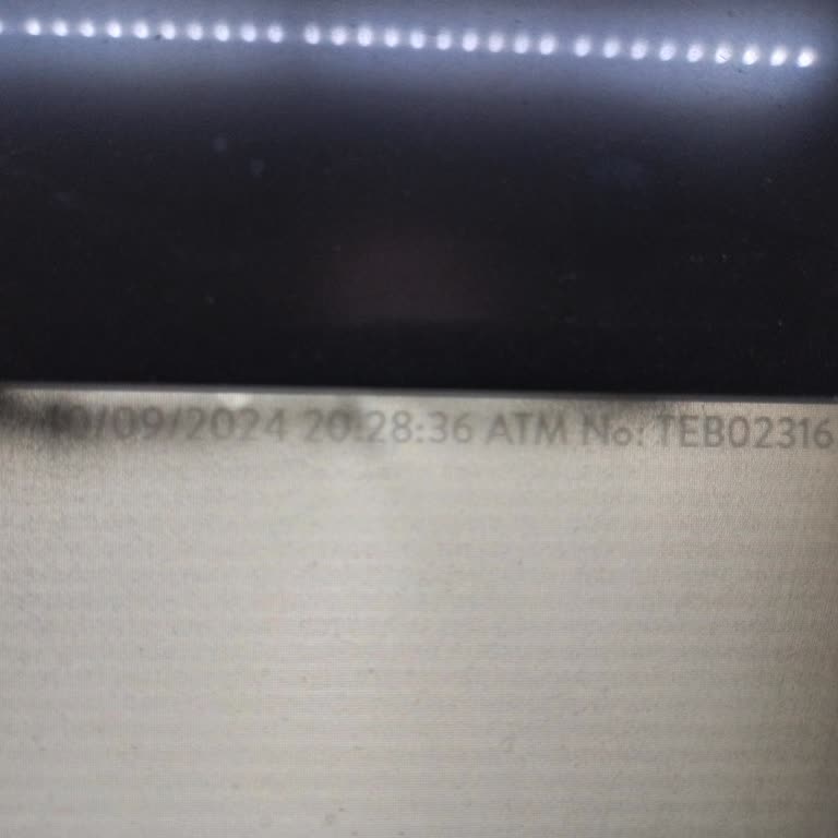 Arnavutköy Devlet Hastanesi Bankamatik Parama El Koydu