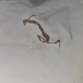 Fellas Granola İçinden Yabancı Madde Çıkması