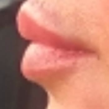 Zes Clinic Kötü İşlem Mağduriyeti