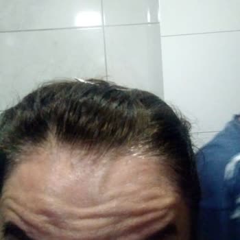 Zes Clinic Kötü İşlem Mağduriyeti