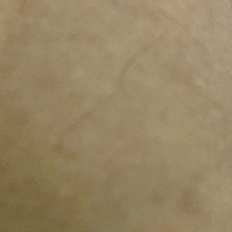 Defne Estetik Lazer Mağduriyeti Ve Çözüm Sıfır