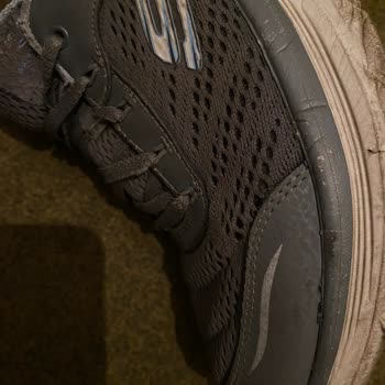 Skechers Ayakkabı Deformasyon Problemi Hk.