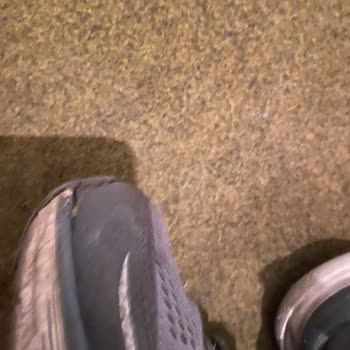 Skechers Ayakkabı Deformasyon Problemi Hk.