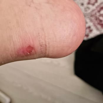 Skechers Ayakkabı Pişmanlığı Asla Alışveriş Yapılmaması Gereken Firma
