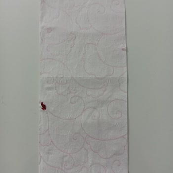 Selpak Tuvalet Kağıdında Kırmızı Lekeler