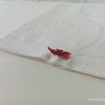 Selpak Tuvalet Kağıdında Kırmızı Lekeler