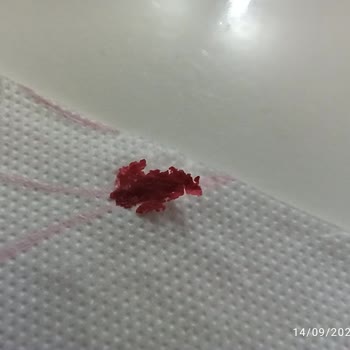 Selpak Tuvalet Kağıdında Kırmızı Lekeler