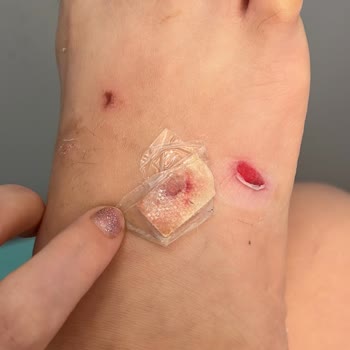 Bambi Ayakkabı Ürünün Arızasını Kabul Etmiyor