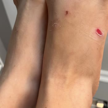 Bambi Ayakkabı Ürünün Arızasını Kabul Etmiyor