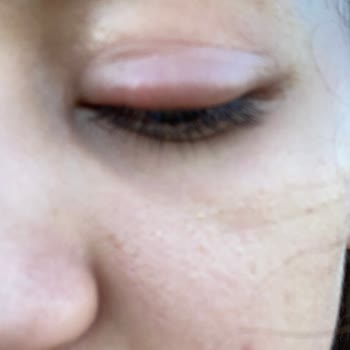 Doruk Nilüfer Hastanesi Göz Sağlığımı Aldınız