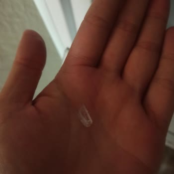 Uğur Derin Dondurucu Çekmece Dişi Kırılması