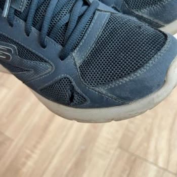 Skechers Ayakkabı. Deforme Olması