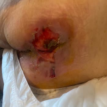 Medicana Avcılar Yoğun Bakım Şikayeti