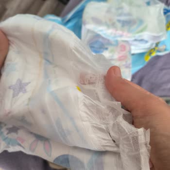 Molfix Bebek Bezi Hatalı Üretilmiş.