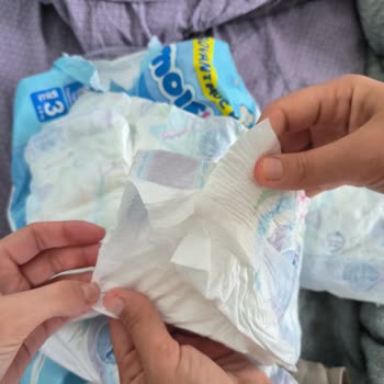 Molfix Bebek Bezi Hatalı Üretilmiş.