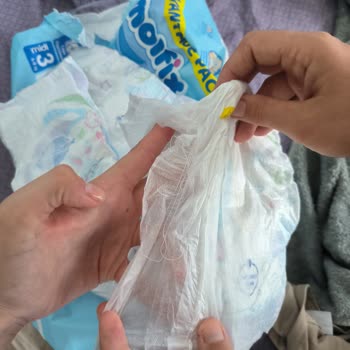 Molfix Bebek Bezi Hatalı Üretilmiş.