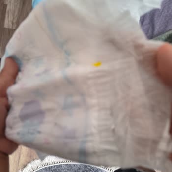 Molfix Bebek Bezi Hatalı Üretilmiş.