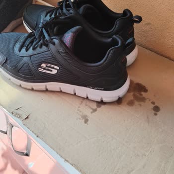 Skechers Refused to Help After Their Men's Sports Shoes Hurt My Heel After 14 Days
