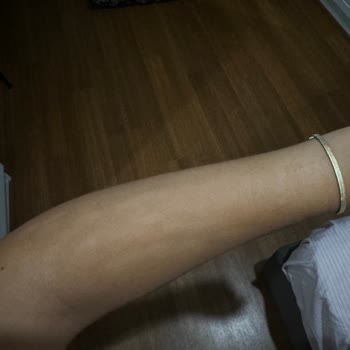 Riomi Kıl Yok Edecek Derken Cilt Hasarı Oluşturdu