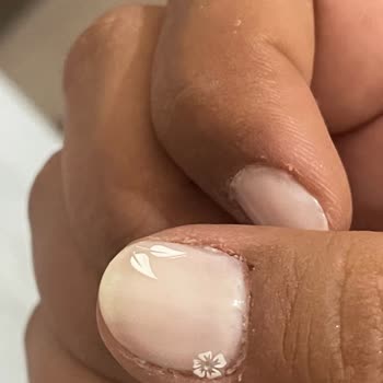 Epilady Kişisel Bakım Salonu Epilady S. Beyli Tırnak Vakası