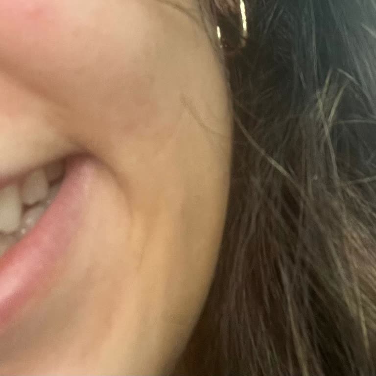 Beyaz Çizgi Ağız ve Diş Sağlığı Polikliniği Estetik Dolgu İşleminde Yaşadığım Sorunlar Ve Mağduriyet