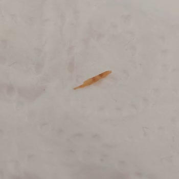 Eti Gıda Bisküvi İçinden Çıkan Sivri Cisim