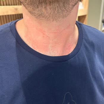 Sevil Parfümeri Online'dan Aldığım Burberry Hero Parfüm Tahriş Yaptı