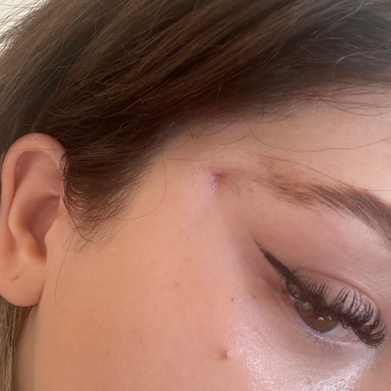 Quartz Clinique Kaş Tedavisinde Yaşanan Sorunlar Ve Pişmanlık