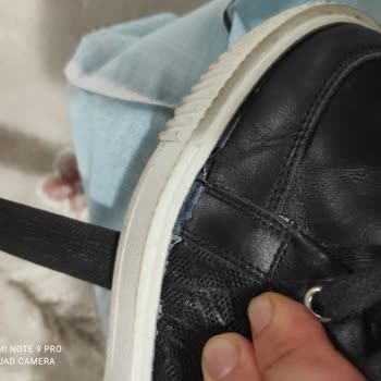 Tamer Tanca Ayakkabı Açılması Ve İlgilenilmemesi