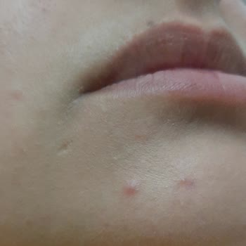 Maruderm Maruz Derm Markası