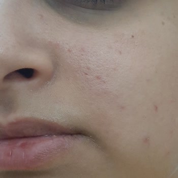 Maruderm Maruz Derm Markası