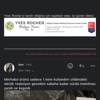 Yves Rocher Ürün Alerji Yaptı