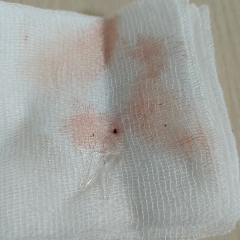 İzmir Bayraklı Şehir Hastanesi Yetersiz Müdahale Ve İlgisizlik