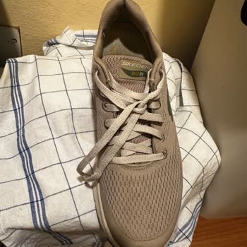 SuperStep Skechers: Zapatos se deshacen en 2 meses