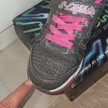 Compré zapatos Skechers y se deformaron en 30 días
