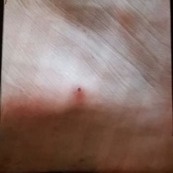 Zapatos Adidas incómodos y falta de atención al cliente