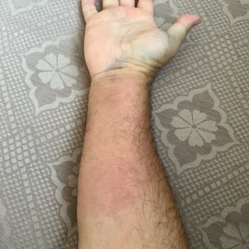 Renault Koleos 2018 - Fallo del Airbag en Accidente Grave