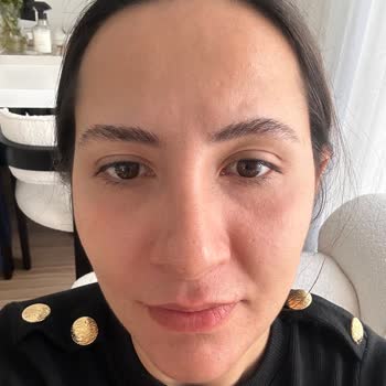 La Roche-Posay Quemó Mi Piel, Quiero Reembolso