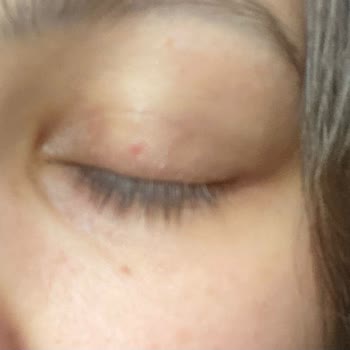 La Roche-Posay Mascara Me Causó Irritación Ocular