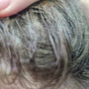 Yves Rocher Champú Anticaída causa caída del cabello