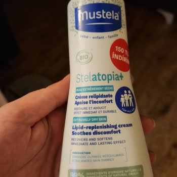 Mi bebé desarrolla erupciones y alergias con productos Mustela