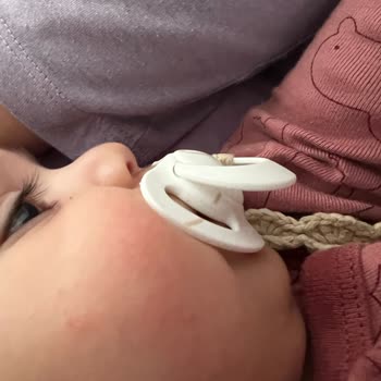 Mustela Stelatopia Crema Emoliente Causando Reacciones Alérgicas