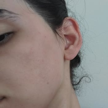 Irritación en la piel tras usar Bepanthol Repair Cream