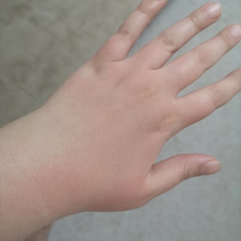 Reacción alérgica con Bepanthol Sensiderm - Sin ayuda del servicio al cliente