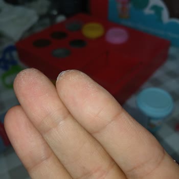 Fisher-Price "Learning Shapes" Plastilina Deja Residuo Blanco en la Piel